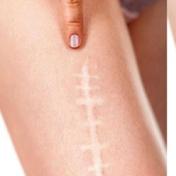 Avene Cicalfate+ Gel de Massage 30 ml - 3