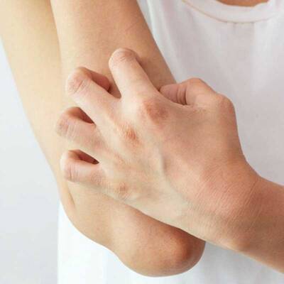 Avene XeraCalm A.D Creme 400 ml - 2