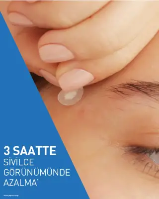 CeraVe Blemish Barrier Patch Sivilce Bandı ​- 22 Adet - 4