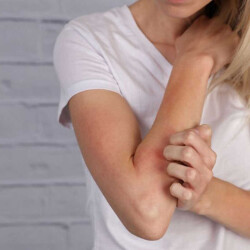 Ducray Dexyane Baume Emolliente Anti Grattage 200 ml - 3