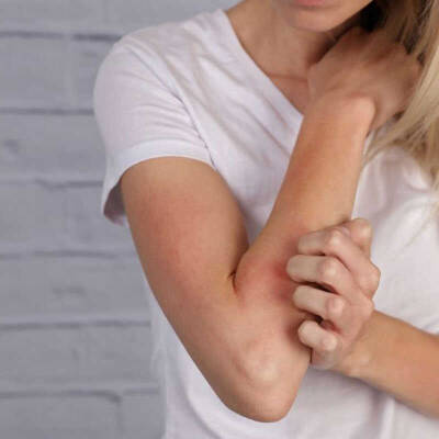 Ducray Dexyane Baume Emolliente Anti Grattage 200 ml - 3