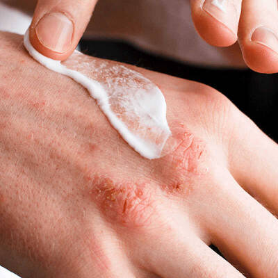 Ducray Dexyane Creme Emolliente Anti Grattage 400 ml - 3