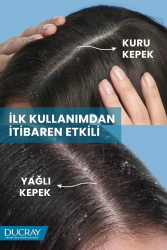 Ducray Kelual Squanorm Lotion Fresh Contrôle 200 ml - 4