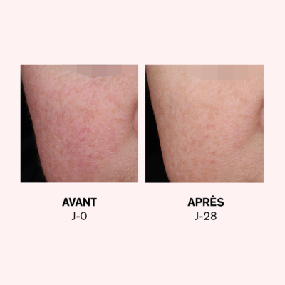 Lierac Rosilogie Double Concentrate Neutralisant Rougeurs Installees 30 ml - 4