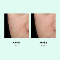 Lierac Sebologie Double Concentre Resurfacant Imperfections Installees 30 ml - 3