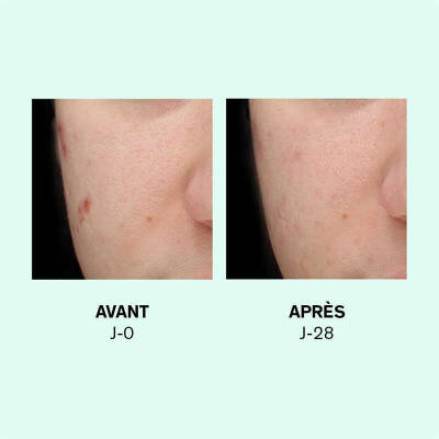 Lierac Sebologie Double Concentre Resurfacant Imperfections Installees 30 ml - 3